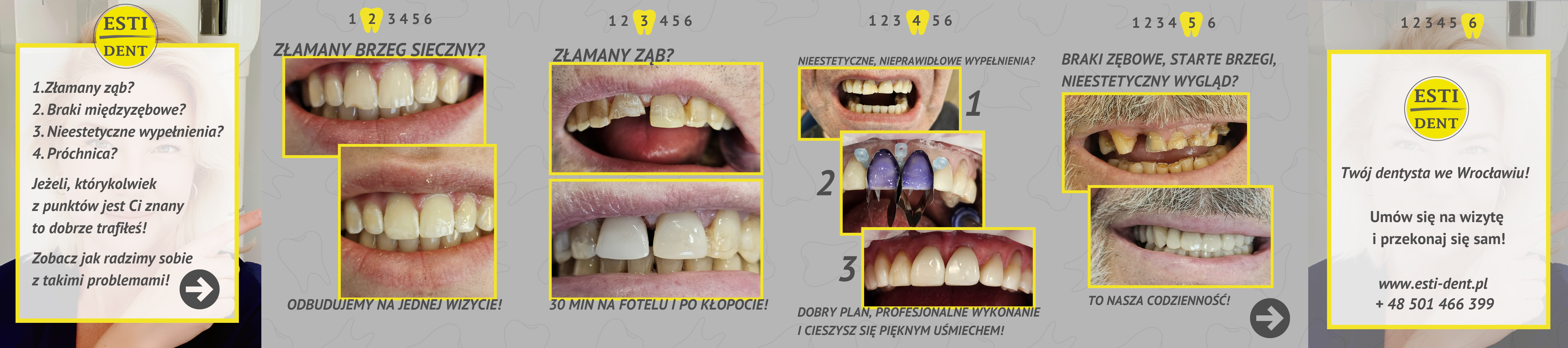 Karuzela edukacyjna na Instagramie – Esti-Dent